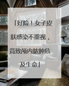 好险！女子皮肤感染不重视，竟致颅内脓肿危及生命